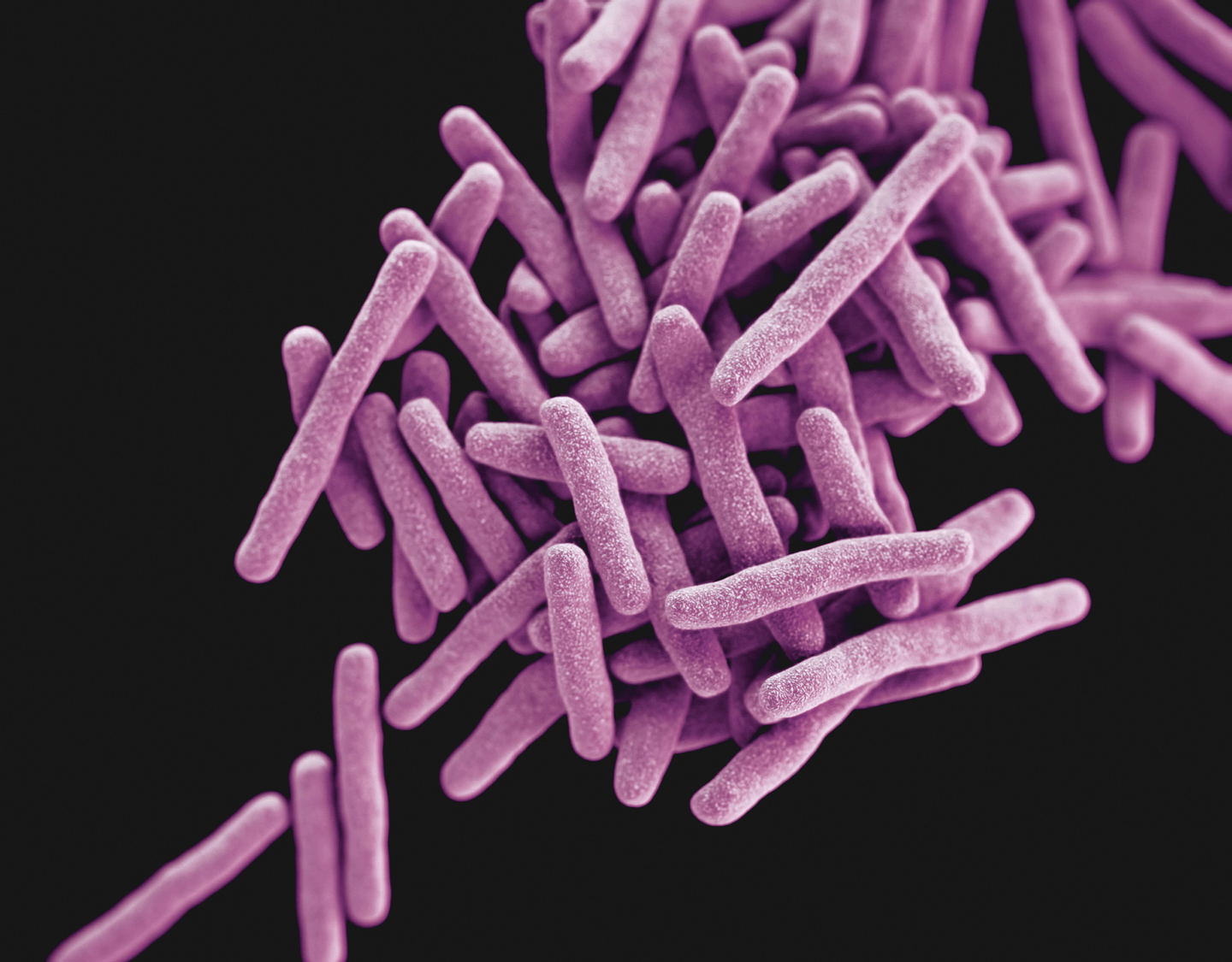 tuberculosis bacteria