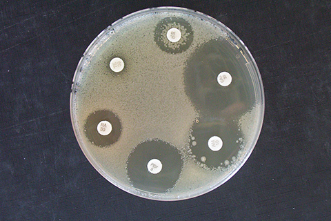 Identification de microorganismes par séquençage d’ADN / Antibiorésistance