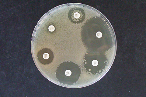 GenoScreen, the world leader in tuberculosis genotyping GenoScreen, the world leader in tuberculosis genotyping