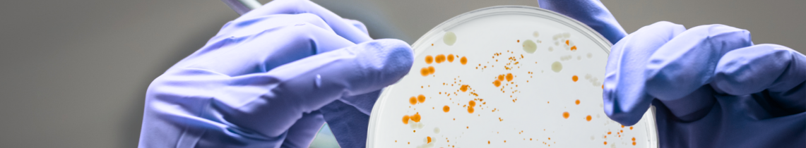 Metagenomics for the analysis of microbiomes