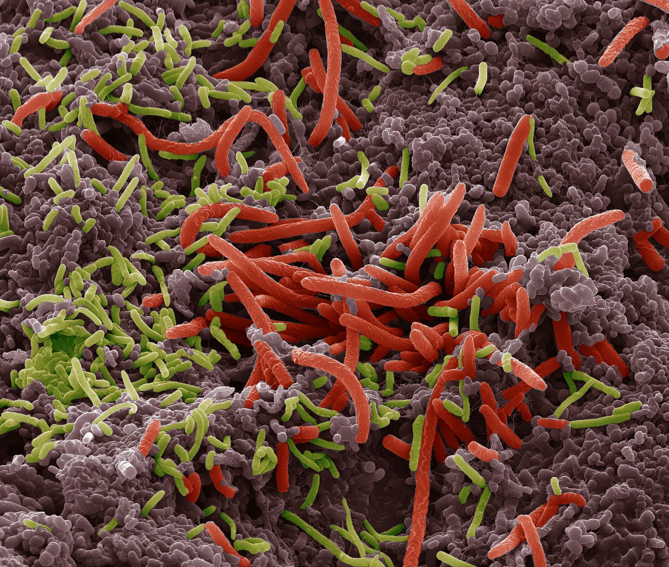 Intestinal microbiota{